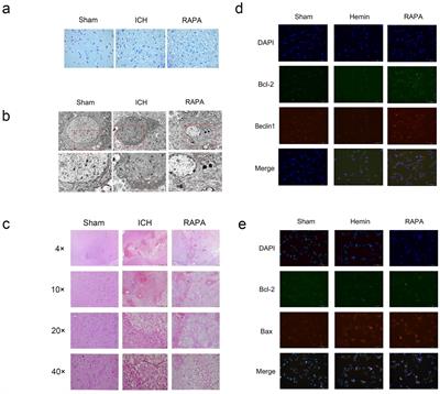 A crosstalk between autophagy and apoptosis in intracerebral hemorrhage